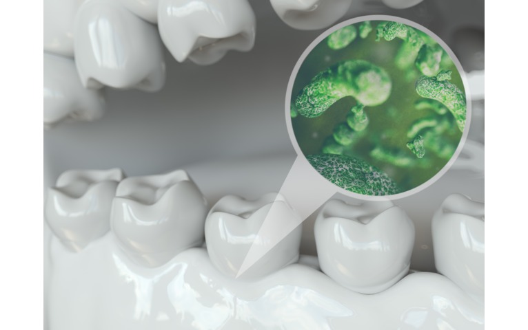Baktérie sa usadia na zuboch do 24 hodín po zubnej hygiene